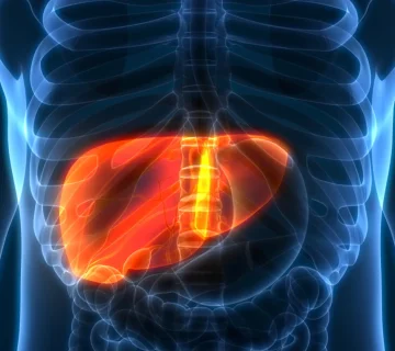 سرطان کبد